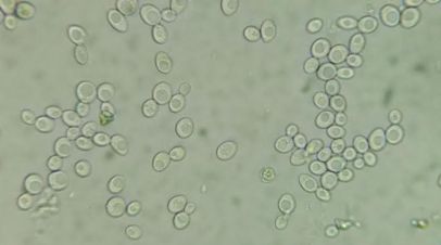 Wyeast 1272 American Ale II starter culture viewed under 800x magnification.